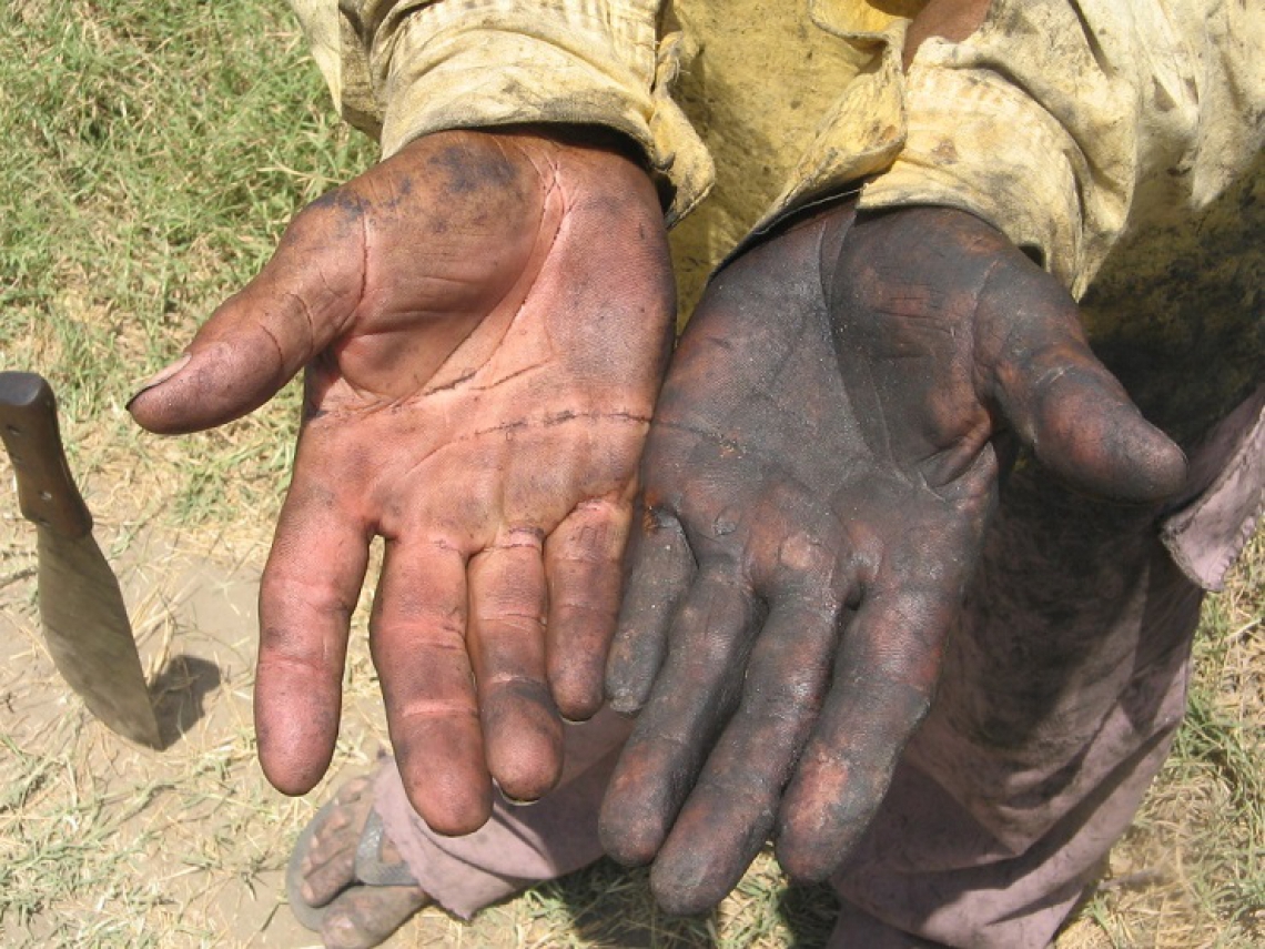 Na foto, as mÃ£os de trabalhadores escravos da Companhia Agro Industrial Vale do Curu, a Agrovale, em Paracuru