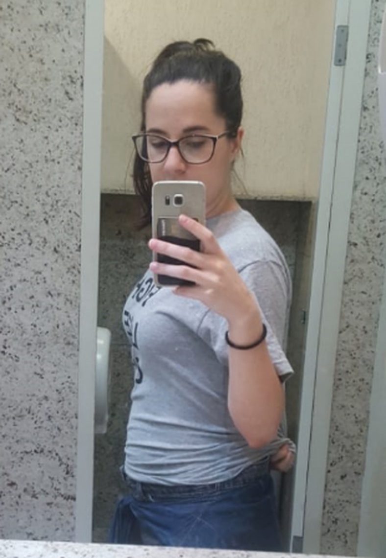 Barriga da Lana com oito meses de gravidez, no dia em que descobriu a a gestação.  