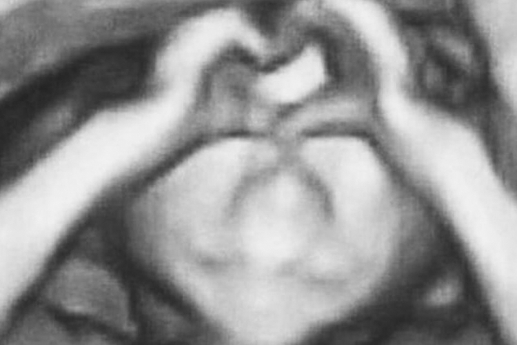 Quando o aparelho de ultrassom 3D foi acionado, Maria Valentina estava nesta posição(foto: Reprodução/Arquivo Pessoal)