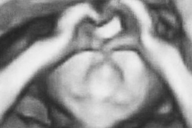 A foto alterada que circulou nas redes sociais brasileiras