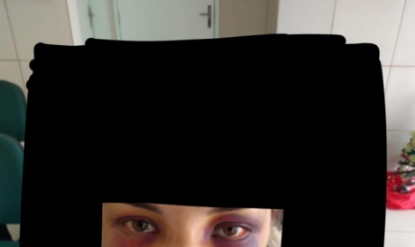 Foto feita na delegacia (com interferência gráfica) mostra graves hematomas no rosto da mulher agredida em Limoeiro do Norte 