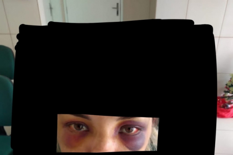 Foto feita na delegacia (com interferência gráfica) mostra graves hematomas no rosto da mulher ...