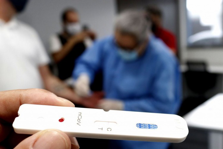 A conclusão do laudo deve mostrar se há confirmação da variante indiana em território cearense