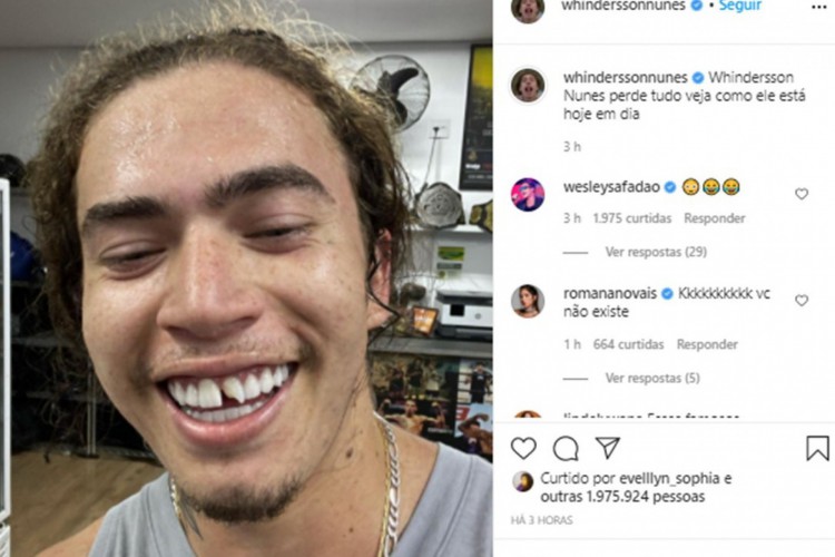 Whindersson mostrou em seu Instagram o novo sorriso, com o dente quebrado, obtido após treino de luta