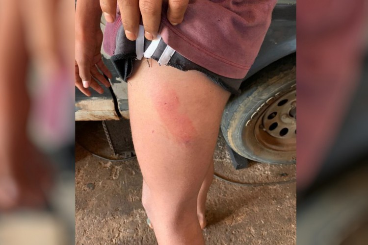 Pol&iacute;cia informou que o menino tinha escoria&ccedil;&otilde;es pelo corpo