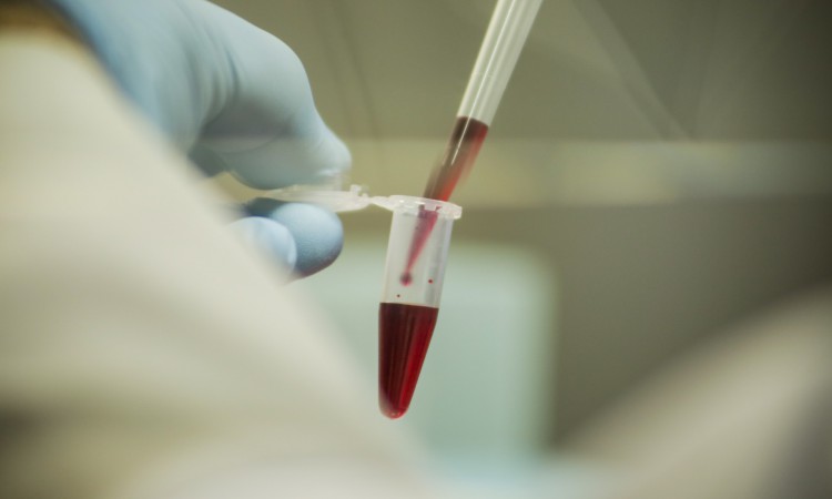 FORTALEZA, CE, BRASIL, 21.05.2021: C&S - UECE produz um possivel imunizante da COVID-19. Laboratorio de Biotecnologia e Biologia Molecular. Bloco D (Thais Mesquita/OPOVO)