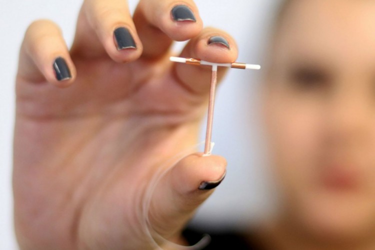 Foto de apoio ilustrativo. DIU &eacute; um dos m&eacute;todos disponibilizados gratuitamente via SUS