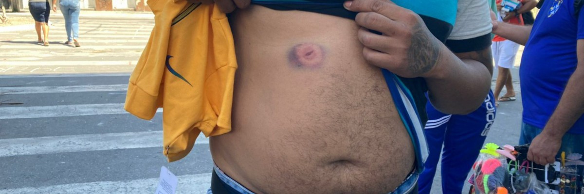 Feirante mostra marca de tiros de bala de borracha após confronto entre Guarda Municipal e feirantes na José Avelino