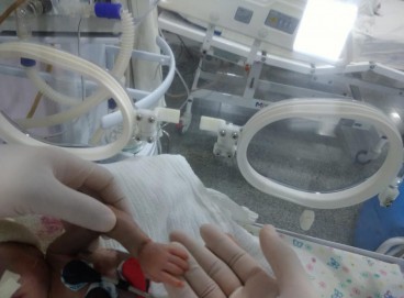 Uma bebê de apenas 700 gramas passou por cirurgia cardíaca de emergência no Hospital do Coração do Cariri, em Barbalha 
