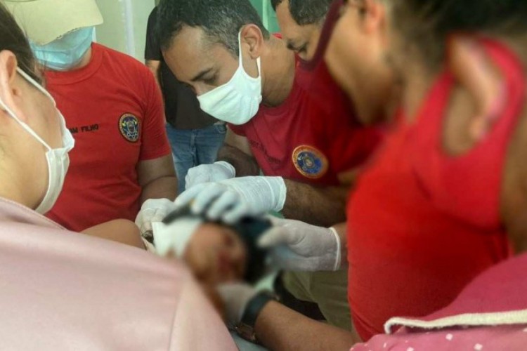 Bombeiros retiram panela de pressão presa na cabeça de criança, em Garanhuns, 