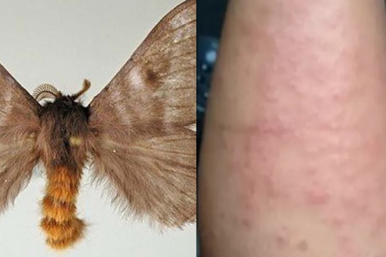 Primeiros casos foram registrados próximos a áreas de Mata Atlântica