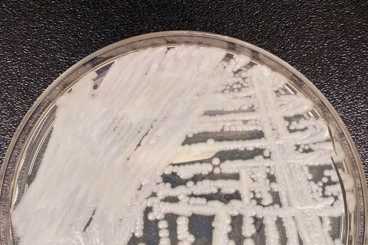 Confirmado segundo caso de Candida auris em PE