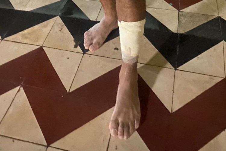 Membro da comissão técnica precisou de atendimento após o ocorrido