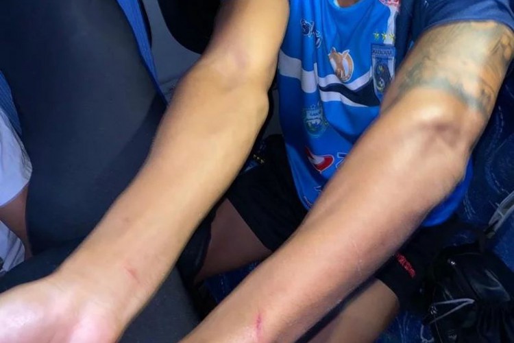 Atletas e comissão se feriram no ataque sofrido no ônibus da equipe