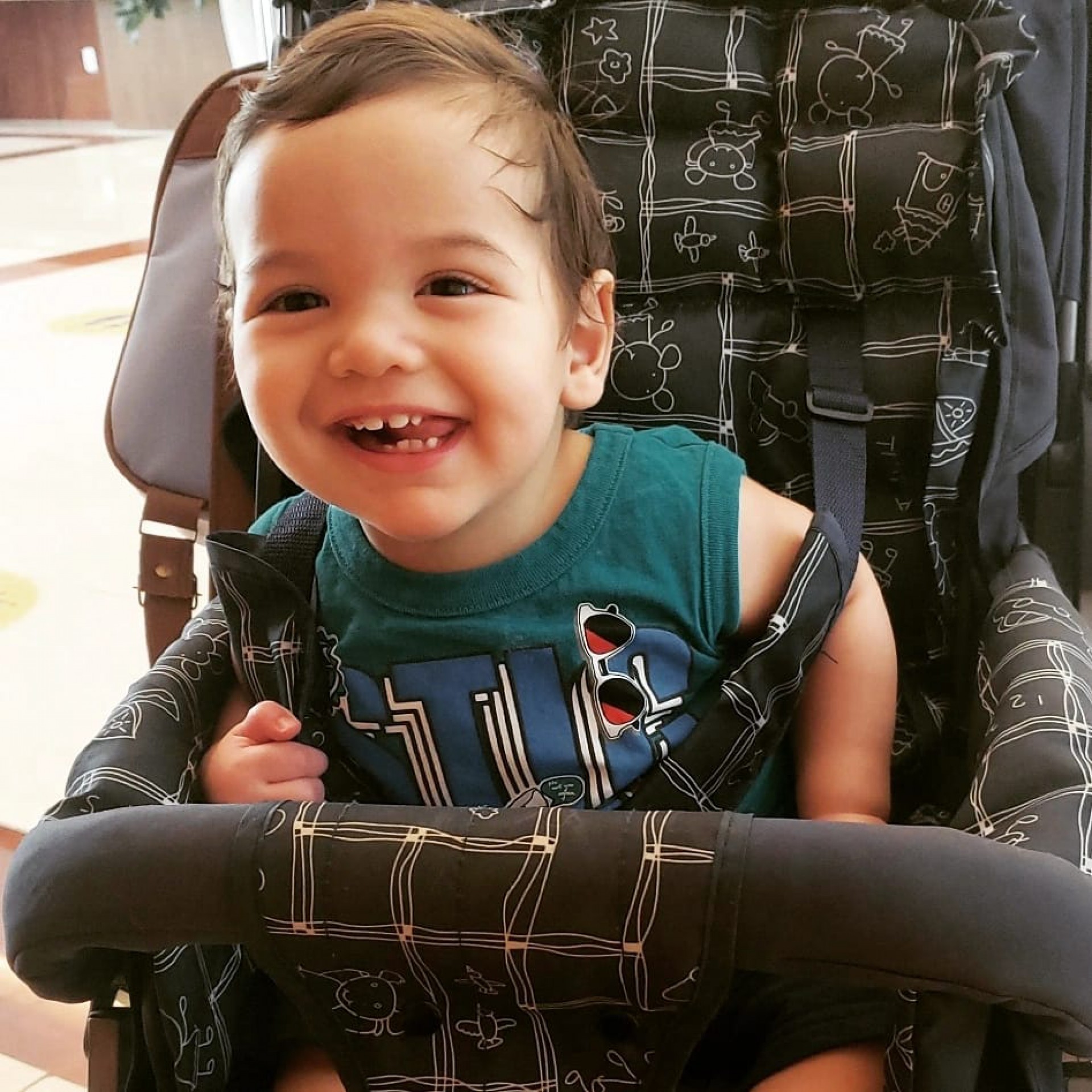 João Miguel, de um ano e três meses, diagnósticado com Síndrome de Fires