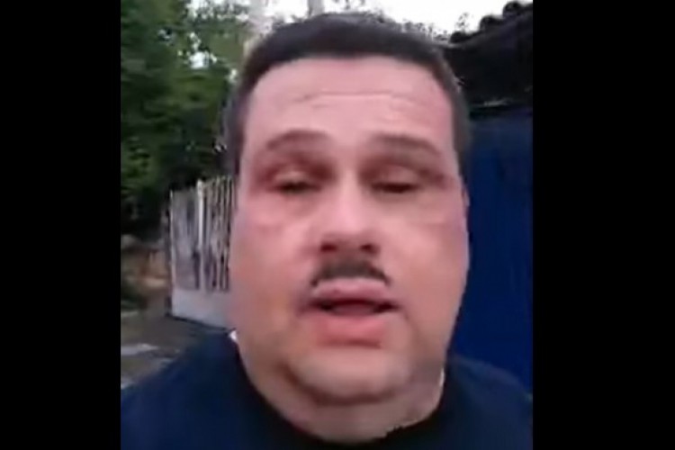 Em live, comerciante acusado de balear vice-prefeito de Atibaia diz ter sido esfaqueado 