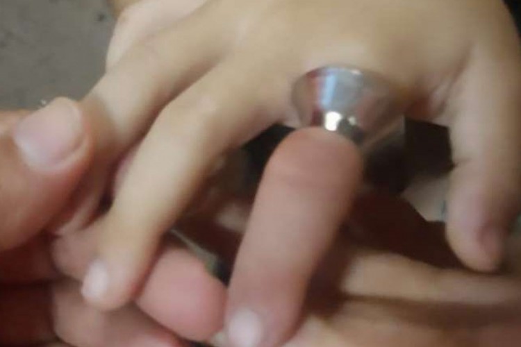 Anel ficou preso no dedo da criança, de 7 anos, e precisou ser removido com o uso de equipamentos dos Bombeiros