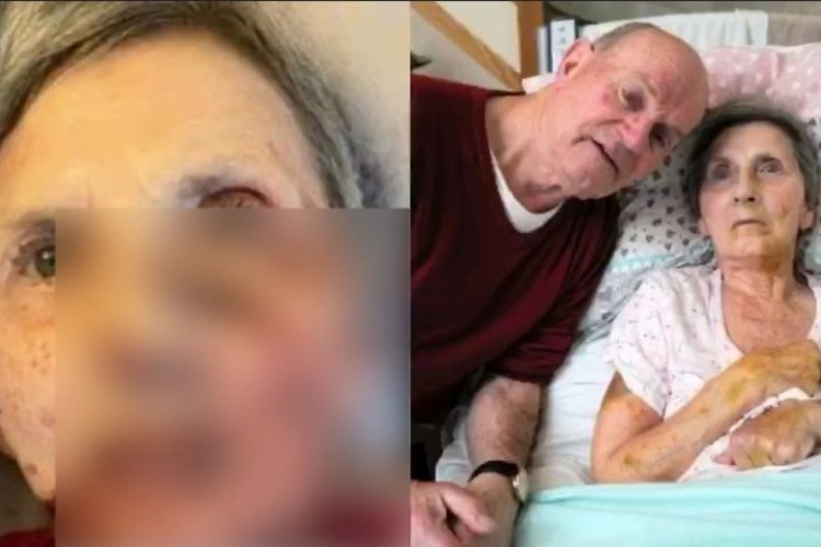 Diana, de 75 anos, foi atacada enquanto dormia.