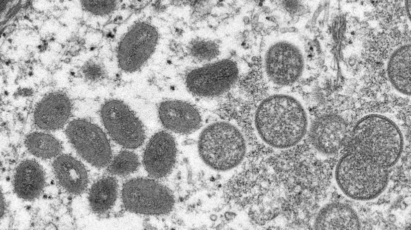 Ceará tem segundo caso de varíola dos macacos(foto: CYNTHIA S. GOLDSMITH)