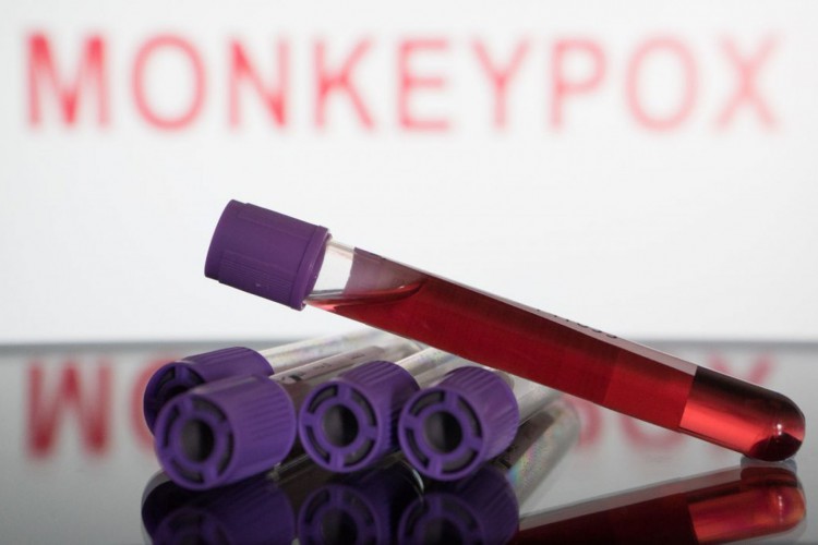 ORGANIZAÇÃO Mundial da Saúde alerta sobre contaminação crescente da varíola dos macacos