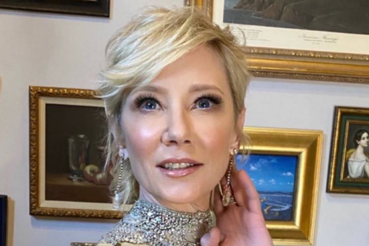 Anne Heche está internada após acidente de carro em Los Angeles
