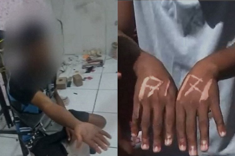 Trabalhadores tiveram as mãos queimadas com os dizeres 