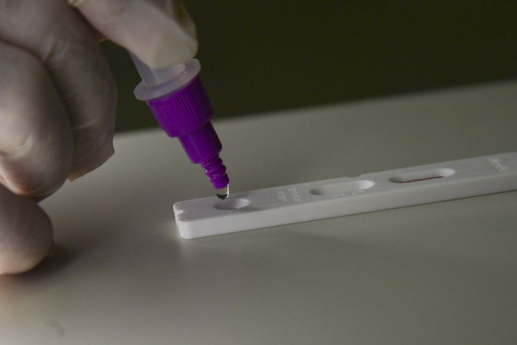 Pela primeira vez, taxa de positividade da Covid-19 em Fortaleza ficou em 0,0%