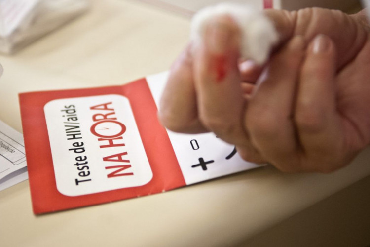 Mortalidade por Aids cai 78% desde 1995 em São Paulo