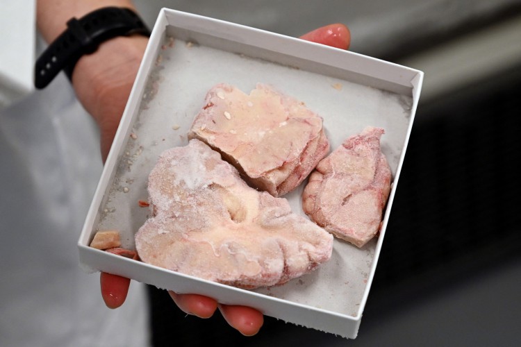 Um funcionário mostra uma caixa com fragmentos de cérebro humano, no laboratório do hospital Bispebjerg, em Copenhague, em 3 de fevereiro de 2023