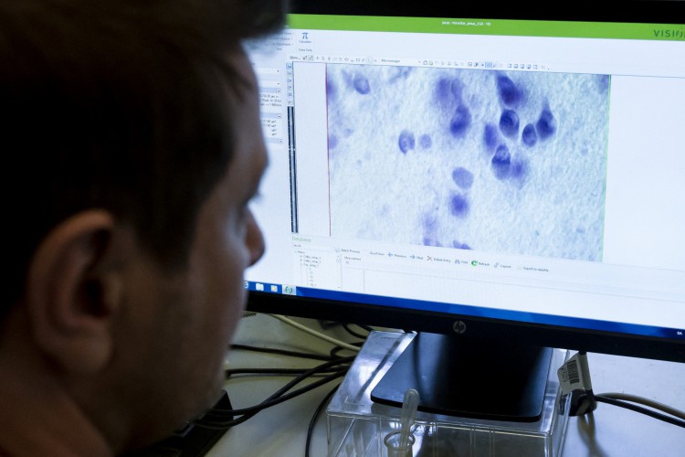 Um funcionário estuda fragmentos de cérebro humano no laboratório do hospital Bispebjerg em Copenhague em 3 de fevereiro de 2023