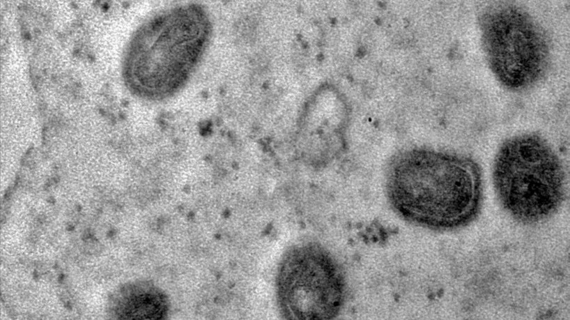 A varíola dos macacos é transmitida pelo vírus monkeypox, que pertence ao gênero orthopoxvirus