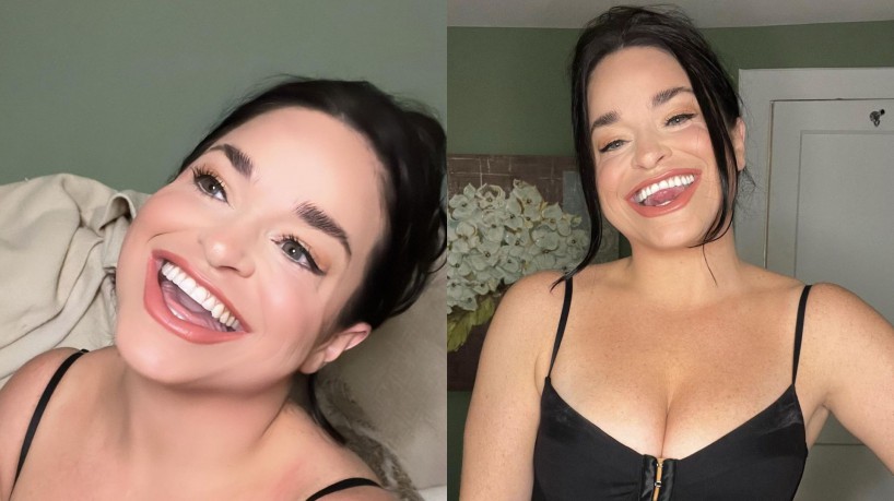 Mulher com a maior boca do mundo entra para livro dos recordes com boca que mede 6,5 centímetros quando aberta