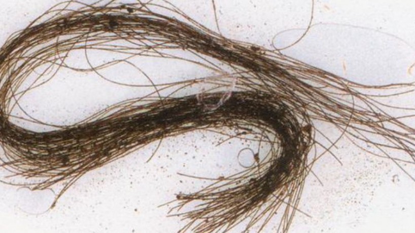 Análises químicas do cabelo detectaram a presença de atropina, escopolamina e efedrina, alcaloides que permanecem fixados em pelos