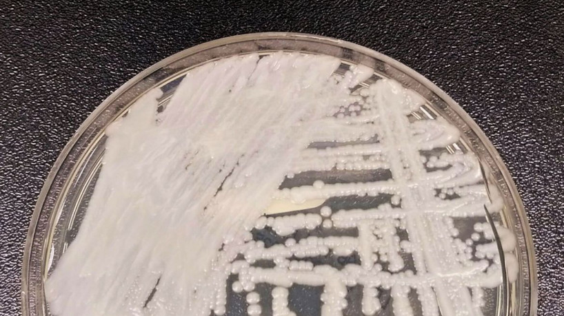 Fiocruz e Pasteur vão pesquisar sobre danos dos fungos no ser humano