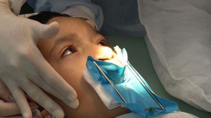 Tratamento de fissura labiopalatal no Centrinho