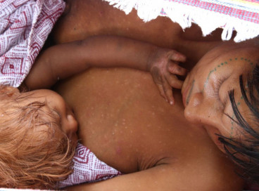 Os Yanomami também sofrem com a contaminação dos corpos de água pelo garimpo, dificultando sua alimentação.