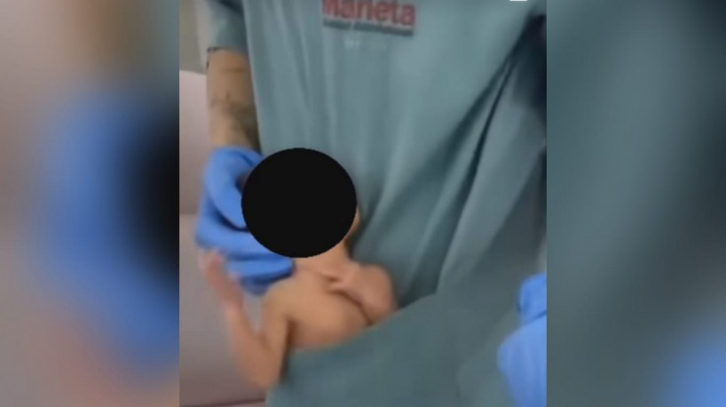 Uma fisioterapeuta foi filmada enquanto fazia uma 