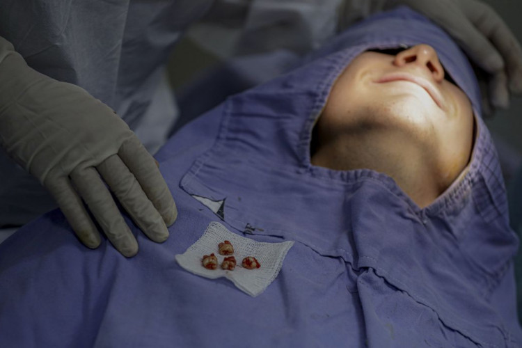 Brasília (DF) 05/10/2023 - Felipe Gabriel Avancini dos Reis observa tem seus 4 dentes sisos extraídos
Ministério da Saúde garante o maior recurso da história para saúde bucal. Serão destinados R$3,8 bilhões em 2024, o que representa mais que o dobro deste ano. Com isso, 22,8 milhões de brasileiros passarão a ter acesso a atendimento odontológico pelo SUSFachada do hospital regional da Asa Norte
Foto: Joédson Alves/Agência Brasil

