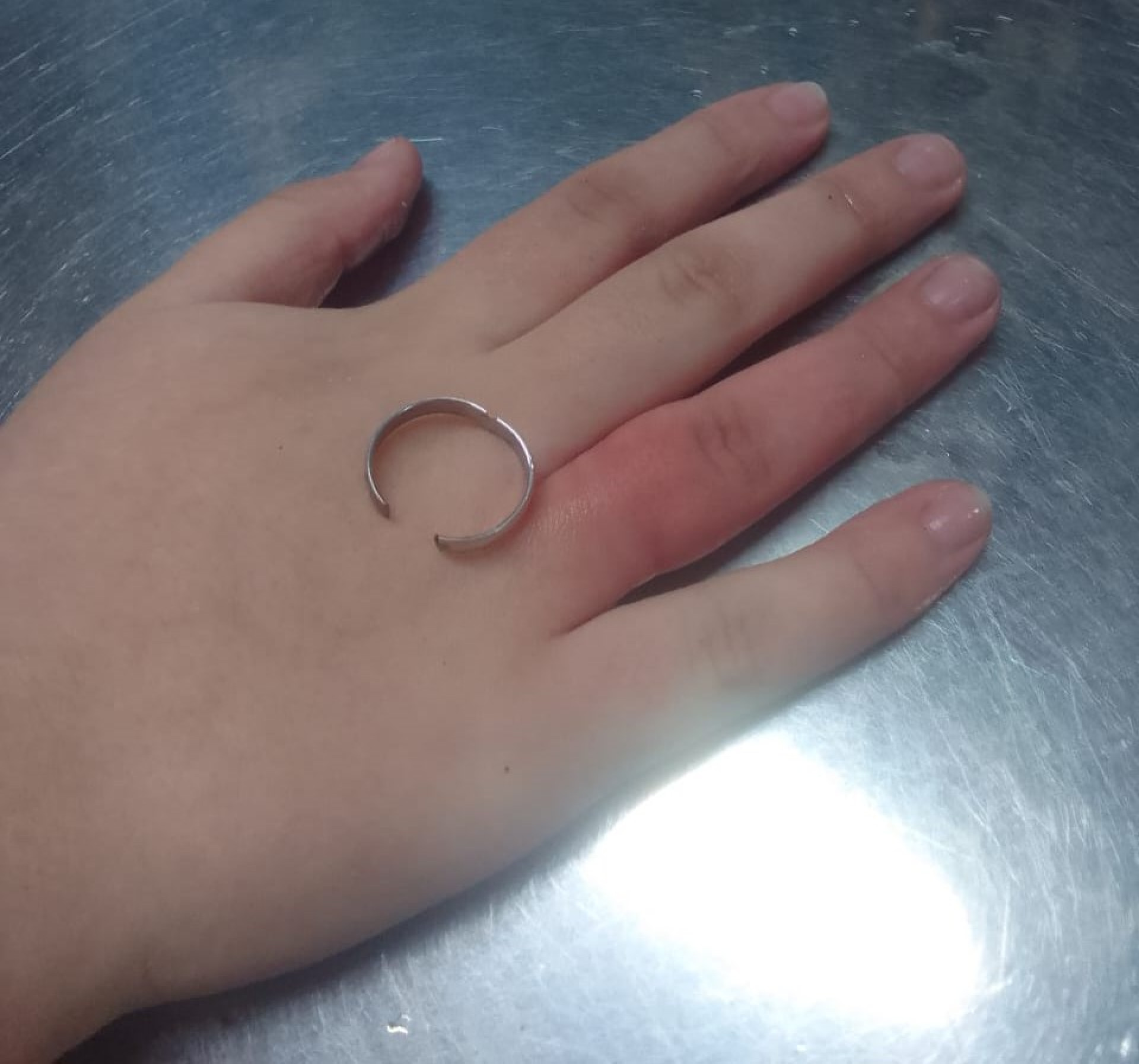 Criança prendeu anel no dedo e foi atendida pelo Corpo de Bombeiros, em Quixadá (Foto: Corpo de Bombeiros do Ceará)