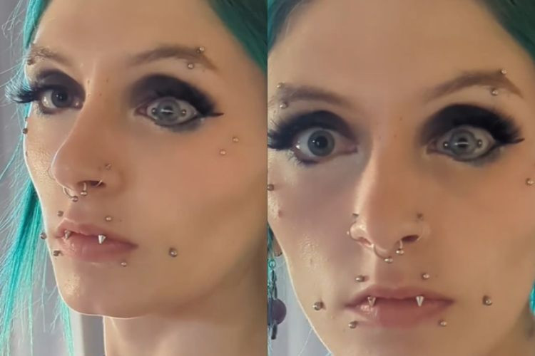 Americana viraliza ao mostrar detalhes de piercing no olho.