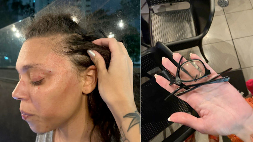 Vítima foi questionada se era 