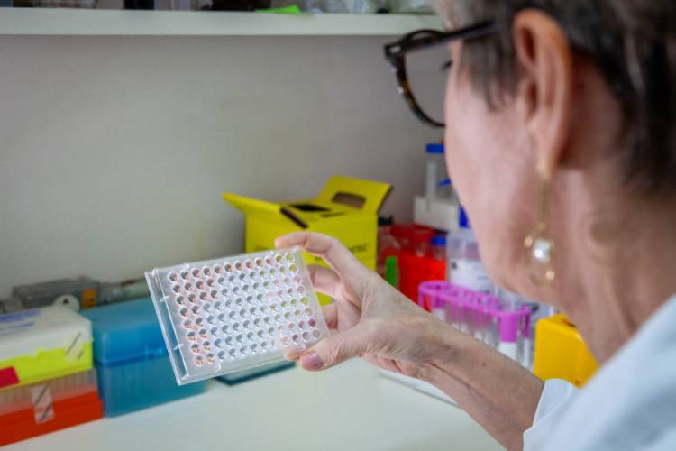 Instituto Butantan desenvolve proteína capaz de identificar leptospirose