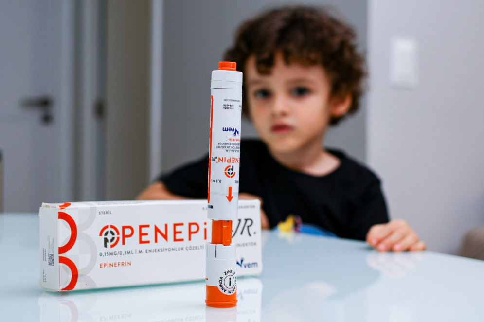 Um episódio de crise alérgica da criança levou a família do pequeno Lucas, 5 anos, a adquirir a caneta autoinjetável (Foto: Yuri Allen/Especial para O Povo)