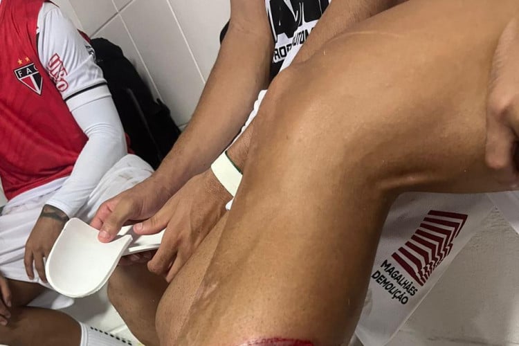 Lesão na panturrilha de Gabryel Martins após o jogo. 