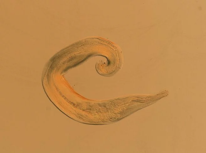 Oxiúro (Enterobius vermicularis): Parasita intestinal que causa coceira anal e insônia, principalmente em crianças. A transmissão ocorre pela ingestão de ovos presentes em alimentos e objetos contaminados.