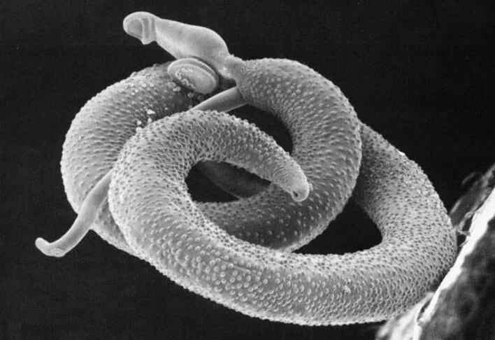 Schistosoma mansoni: Parasita causador da esquistossomose, doença que afeta milhões de brasileiros. A transmissão ocorre pelo contato com água doce contaminada com larvas. Causa sintomas como dores abdominais, diarreia, sangramento urinário e hepatite.