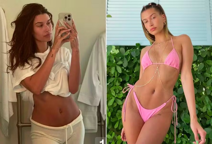 Os boatos em torno da gravidez ganharam força depois que Hailey postou uma foto mostrando a barriga. Alguns fãs atentos notaram que o umbigo dela estaria diferente.
