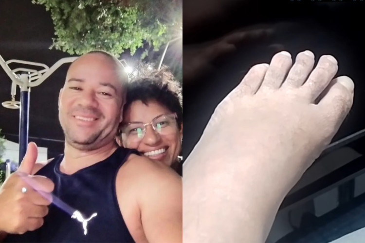 Regilânio da Silva voltou a mexer os dedos dos pés nove meses depois de ser atingido por um aparelho de academia em Juazeiro do Norte
