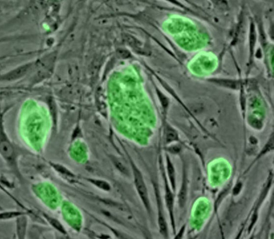 As células-tronco são células que basicamente possuem a capacidade de se transformar em qualquer célula de um organismo. São retiradas do ser vivo e incubadas. 