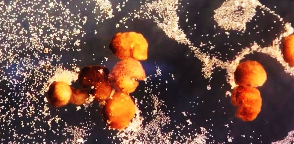 Os cientistas classificam esse tipo de robô como organismo vivo, mas programável, o que causa perplexidade diante de algo que até então era impensável.